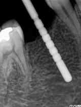 インジケーターで深さと方向を確認